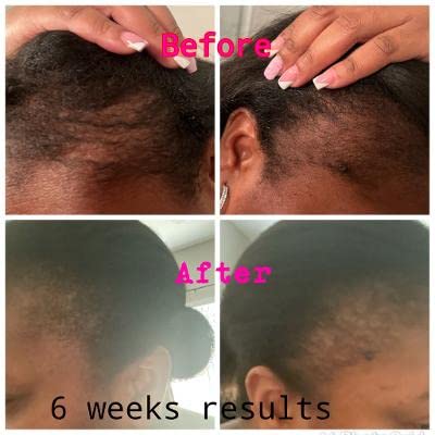 JayMia's Miracle Oil - Love Is In The Hair