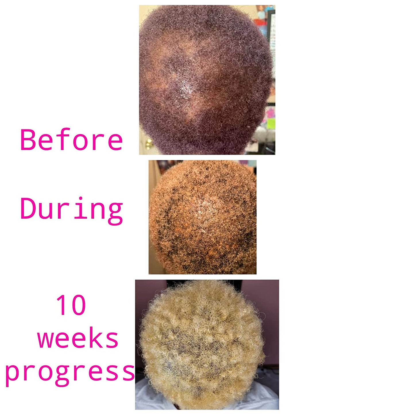 JayMia's Miracle Oil - Love Is In The Hair